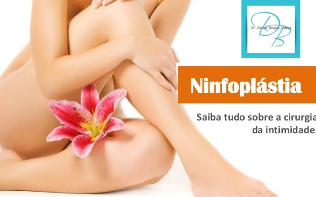 Ninfoplastia Ebook Download